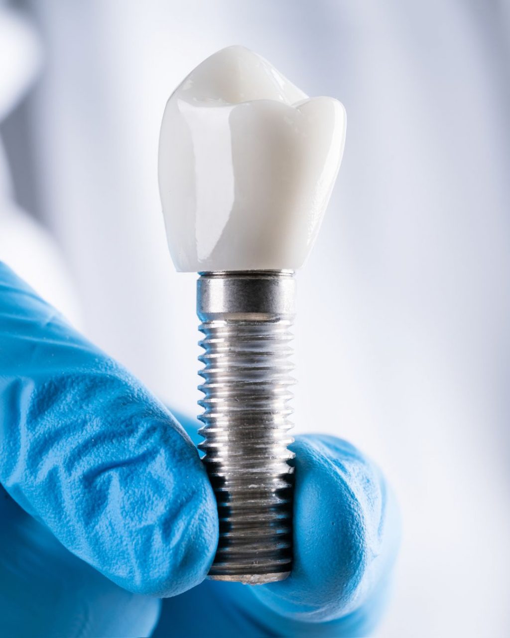 Eine Hand in einem Ärztehandschuh halt ein Zahnimplantat