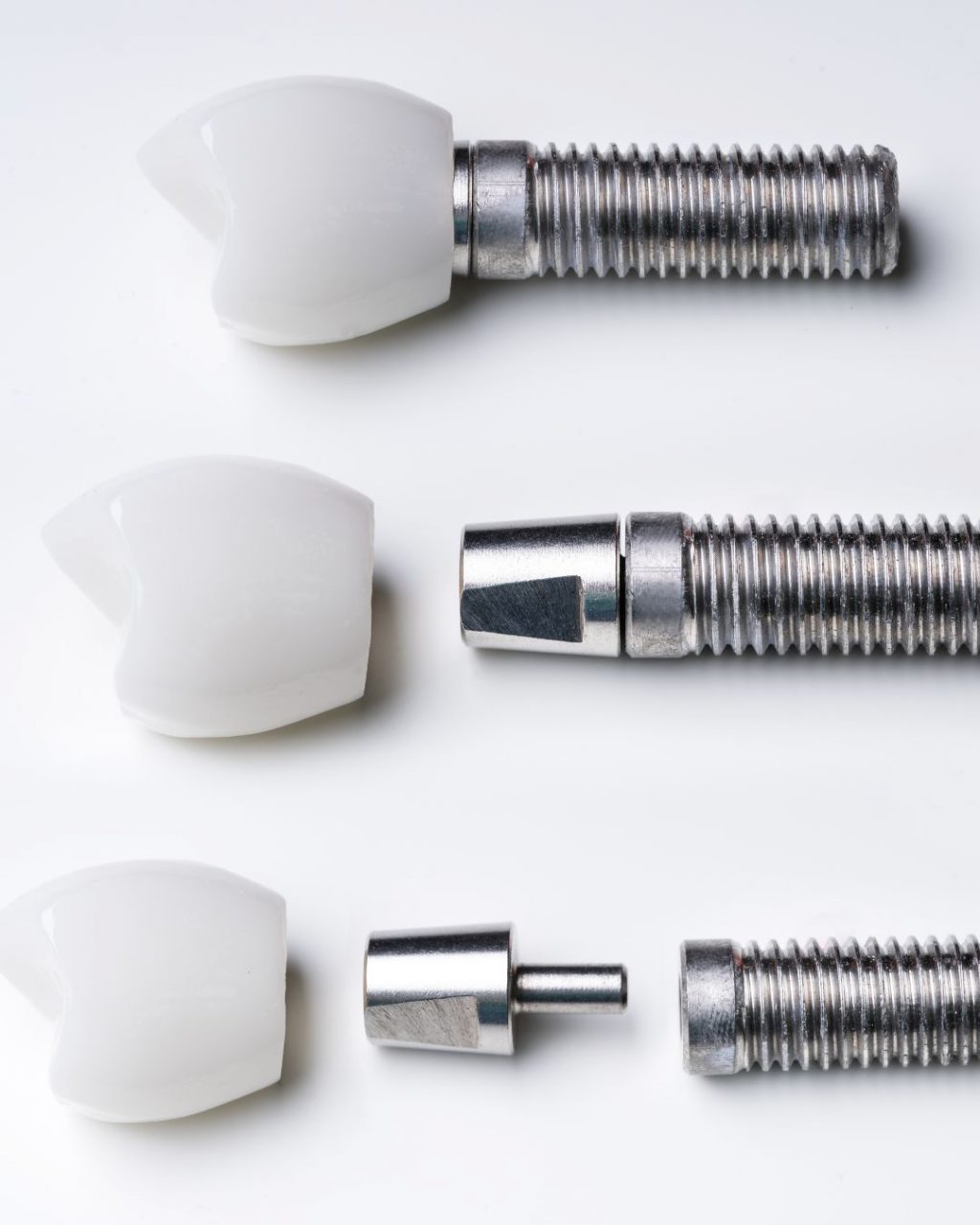 Zahnimplantate nebeneinander aufgereiht, es wird der Aufbau von innen verdeutlicht